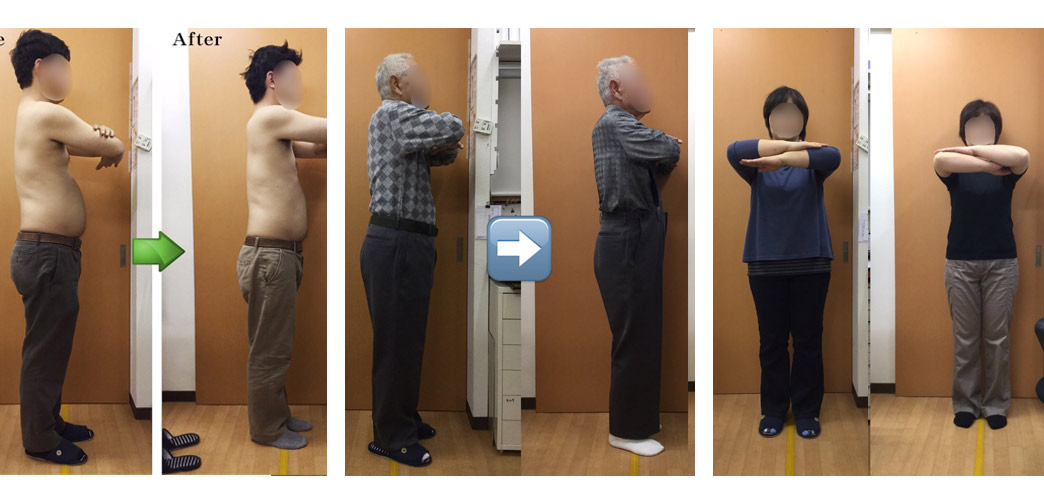 患者さまの治療・施術ビフォーアフター比較写真