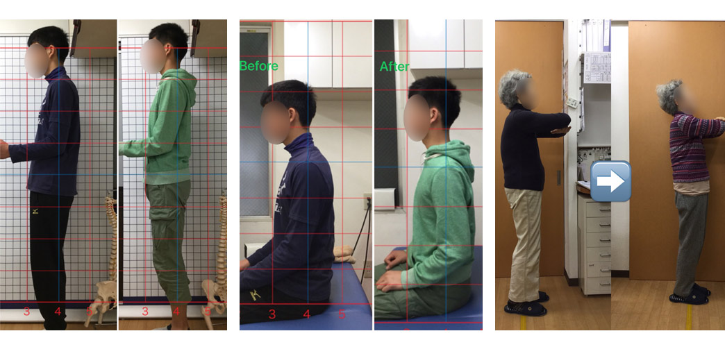患者さまの治療・施術ビフォーアフター比較写真