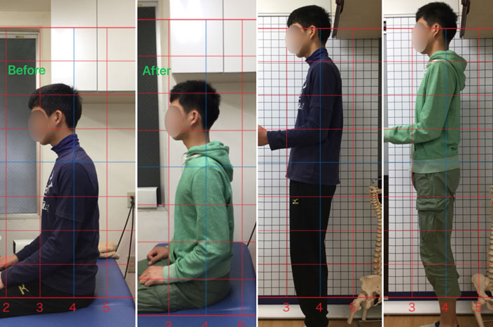 猫背の問題は見た目だけではありません
