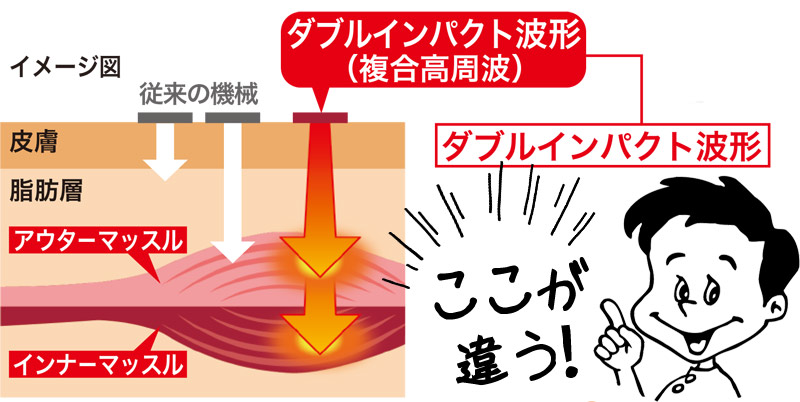 当院のEMSマシン「楽トレ」はここが違います